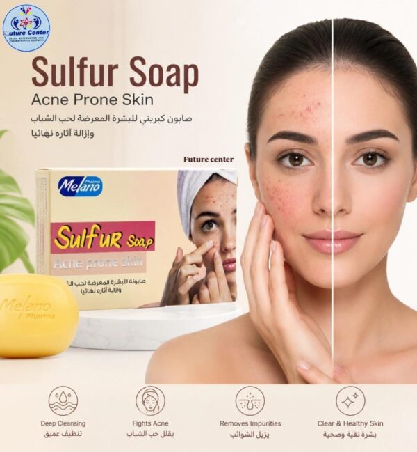 صابون اكني بالكبريت